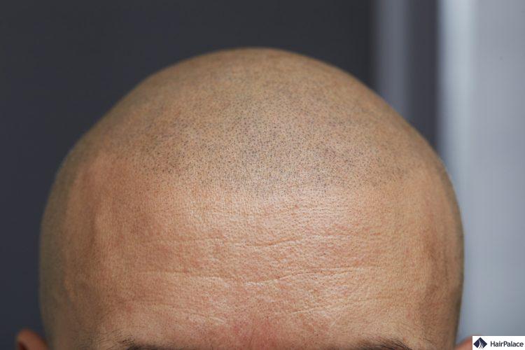 kopfhaare tätowieren